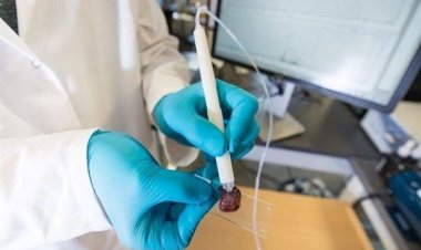 Χειρουργικό «πενάκι» εντοπίζει τον καρκίνο