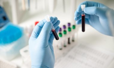 Νέοι σχολαστικοί και αυστηροί περιορισμοί στις διαγνωστικές εξετάσεις των ασφαλισμένων του ΕΟΠΥΥ