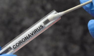 Municipality of Syros: Δωρεάν rapid test Covid 19 την Τετάρτη 9 Δεκεμβρίου 2020