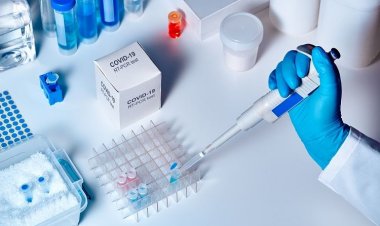 COVID-19 diagnostic testing: Τα μοριακά τεστ για κορωνοϊό είναι πιθανότερο να βγουν θετικά αν γίνουν λίγο μετά το μεσημέρι