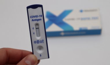COVID-19 Antigen Self-Test: Τι θα κάνουν όσοι βγαίνουν θετικοί μετά το Covid-19 Self test - Η διαδικασία
