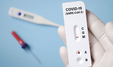 Covid-19 Antigen Self-Test: Ανακοινώσεις σήμερα για Self test - Ποιοι θα υποχρεούνται να το κάνουν - Όχι υποχρεωτική η δήλωση των αποτελεσμάτων!!