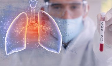 Coronavirus Disease: 1.866 νέα περιστατικά μόλυνσης, το 1 στην Μύκονο  –  759 νοσηλεύονται διασωληνωμένοι, 73 νέοι θάνατοι