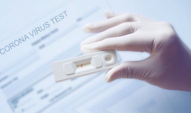 Covid-19 self-testing: Τι πρέπει να κάνουμε αν το test βγει άκυρο!! Για την Μύκονο στο Κέντρο Υγείας 9:00-15:00 τα επαναληπτικά test!!