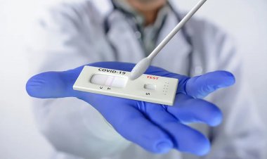 Covid-19 self-testing: Τι ισχύει από τη Δευτέρα για τους εργαζόμενους με τα υποχρεωτικά self test!! Τα 18 SOS [ΚΥΑ]