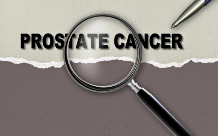 Καρκίνος του προστάτη: 9 οδηγίες για να μην εμφανίσετε ποτέ