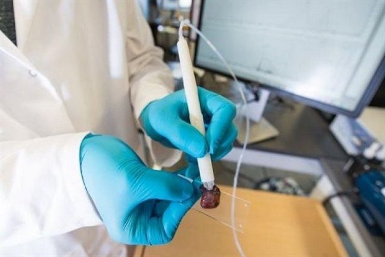 Χειρουργικό «πενάκι» εντοπίζει τον καρκίνο