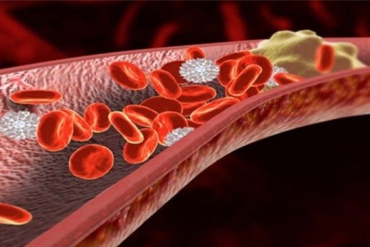 Η θρόμβωση προλαμβάνεται και θεραπεύεται