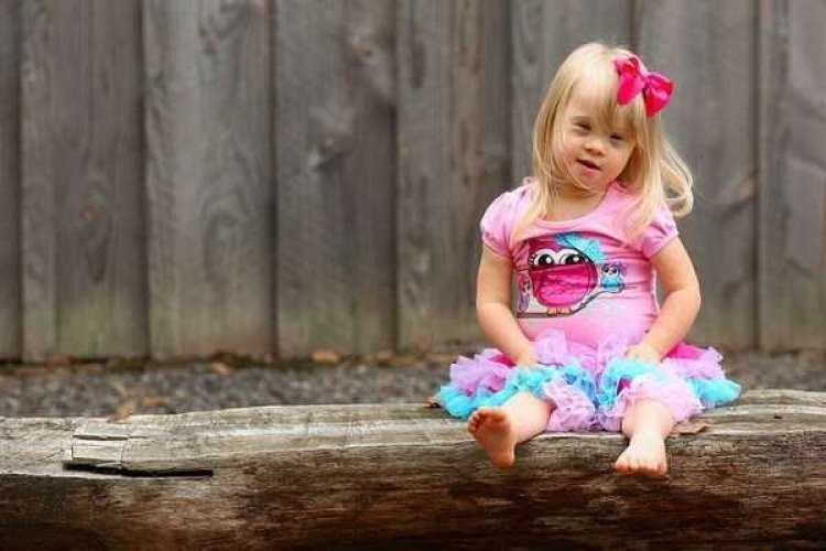 Παγκόσμια Ημέρα Συνδρόμου Down: «What I Bring To My Community» (Video)