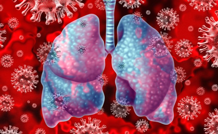 Coronavirus Disease: 19 κρούσματα στο Νότιο Αιγαίο  -   213 κρούσματα σε Αττική, 32 σε Θεσσαλονίκη - Η κατανομή