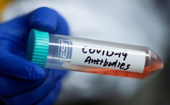 Covid Antibody Test: Πόσα Αντισώματα έχει ο ασθενής και πόσα ο εμβολιασμένος? Τι ισχύει τελικά με τα Τεστ αντισωμάτων?