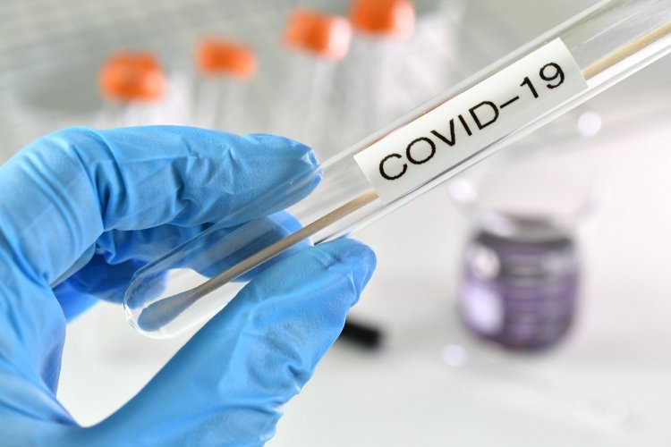 Προσοχή!! Ο ΕΟΦ άμεσα απαγορεύει τη διακίνηση και διάθεση self test Κορωνοϊού!!