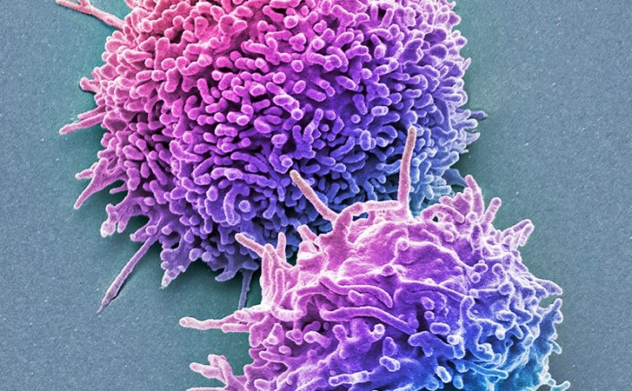 Omicron variant -  T cells: Τα Τ-λεμφοκύτταρα ανθεκτικά απέναντι στην Όμικρον και σε άλλες παραλλαγές του κορονοϊού