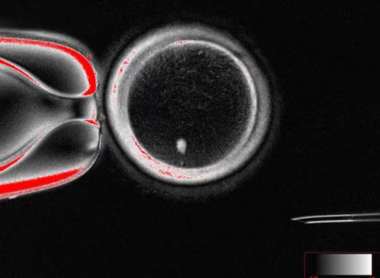 Scientists create human eggs using skin cells: Δημιουργήθηκαν ανθρώπινα έμβρυα από δερματικά κύτταρα, εξέλιξη που φέρνει επανάσταση στην ανθρώπινη αναπαραγωγή